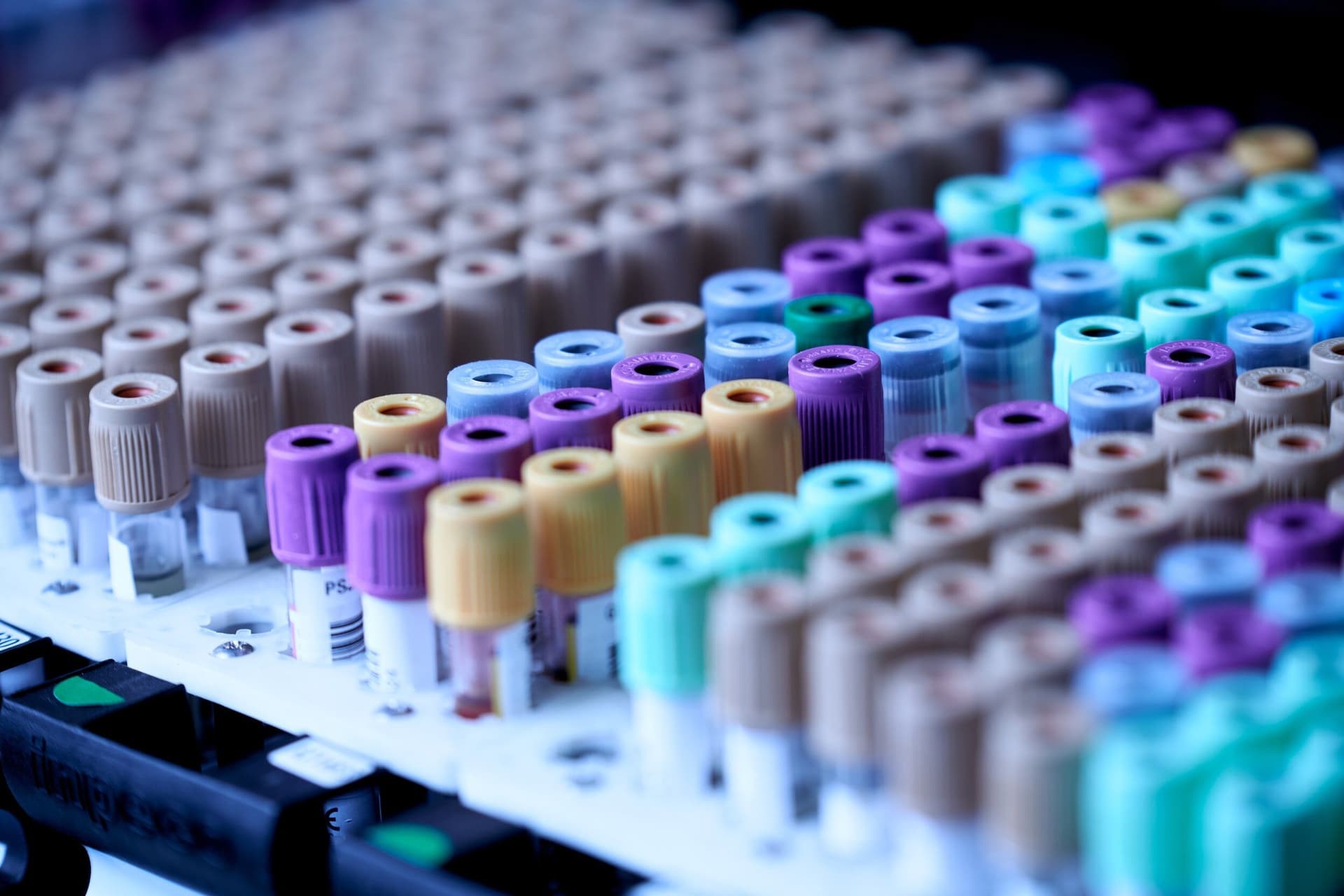 Rows of coloured blood sample tubes in a laboratory rack.